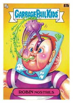 Robin Nostrils