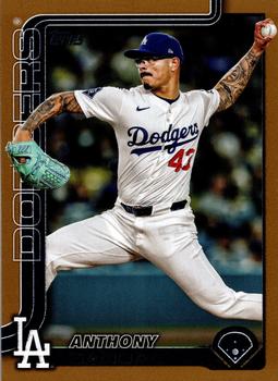 Anthony Banda