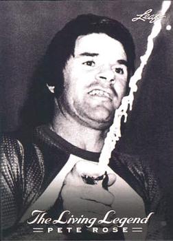 Pete Rose