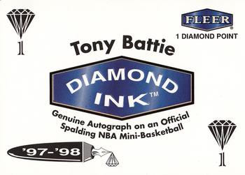 Tony Battie