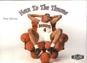 Tony Battie