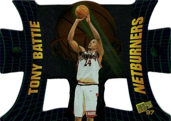 Tony Battie