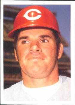 Pete Rose