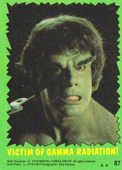 Victim of Gamma Radiation! 