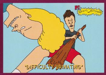 "Difficulty Urinating" 