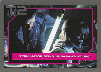 Terminator Sews Up Sarah's Wound 