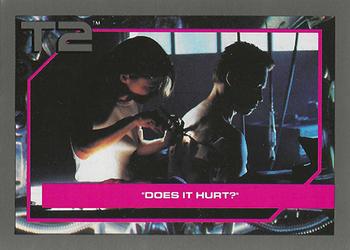 Does It Hurt? 