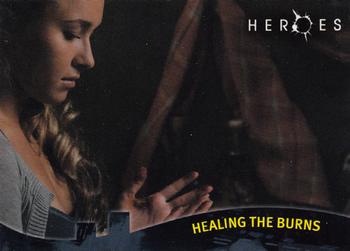 Healing the Burns