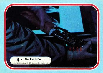The Bionic Arm.