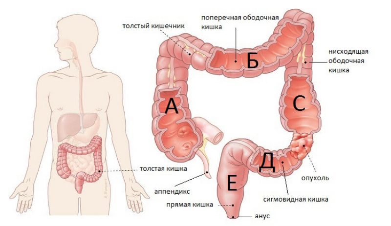 Сильно болят кишки