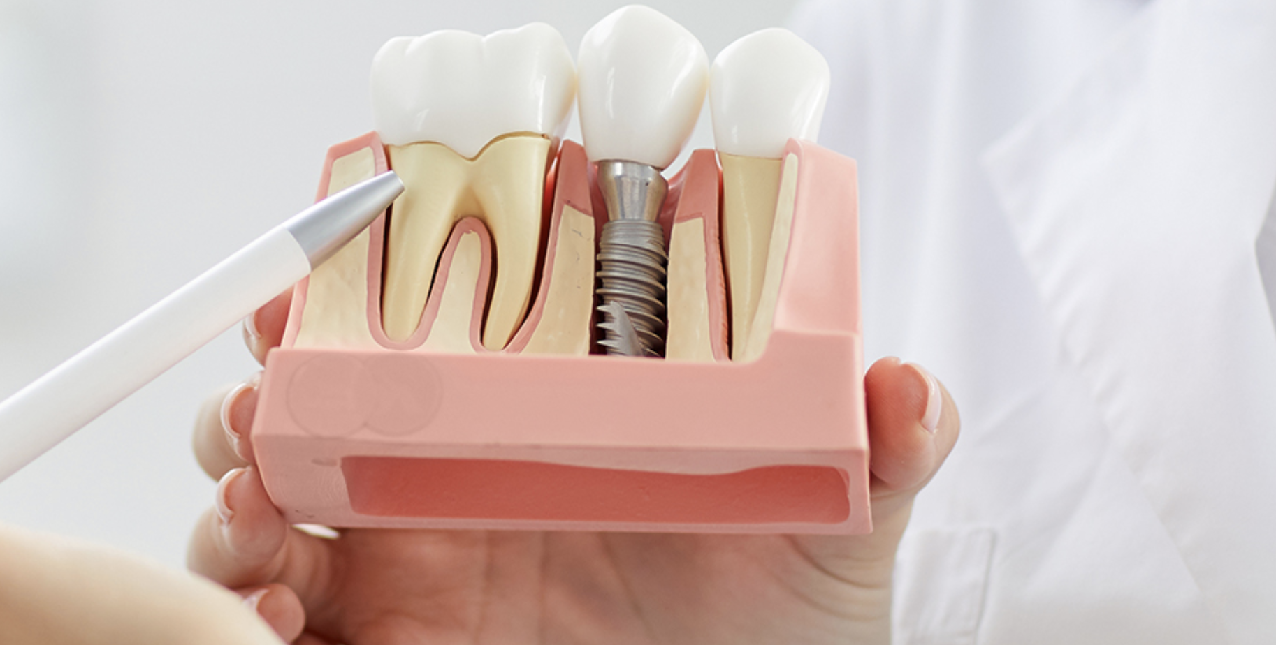 Brighten Your Smile with East Vancouver Cosmetic Dentistry