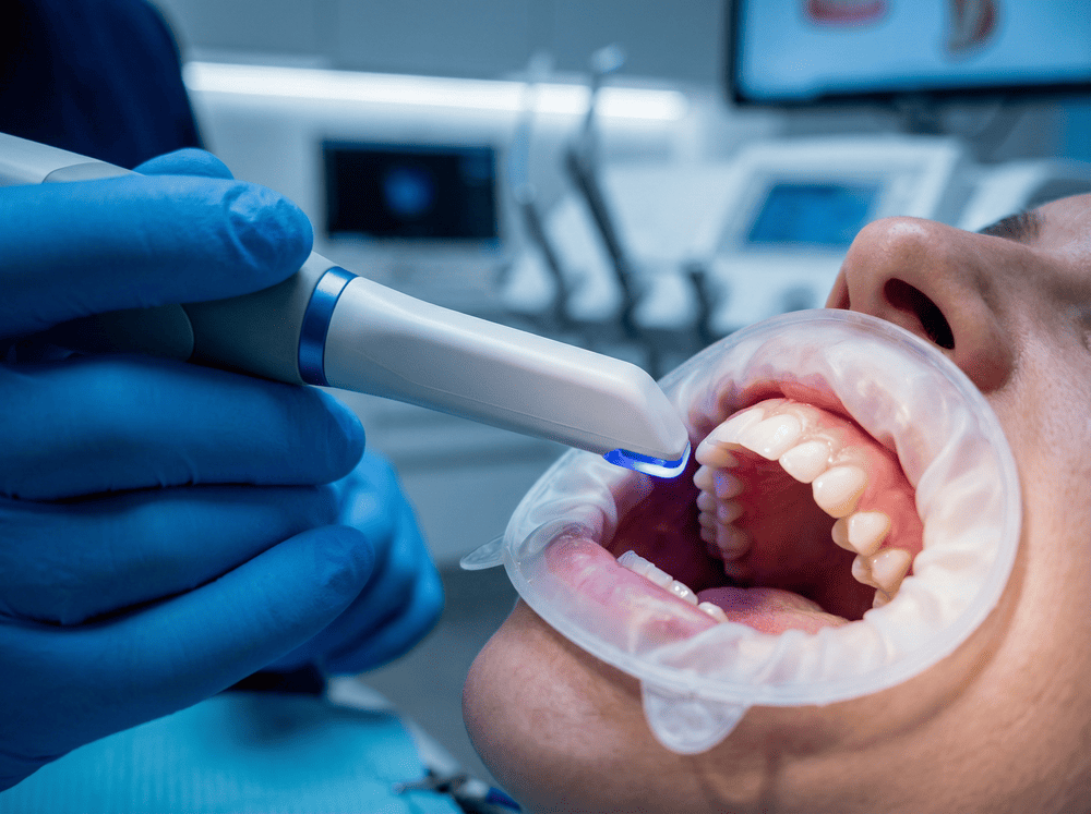 Explore Innovative Dental Scanning Solutions in Encino