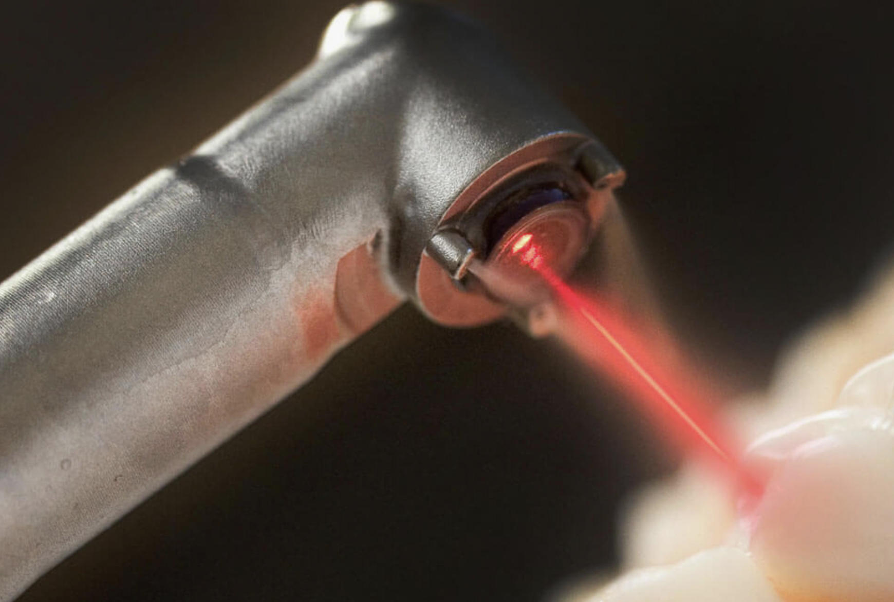 Laser Dentistry Offerings