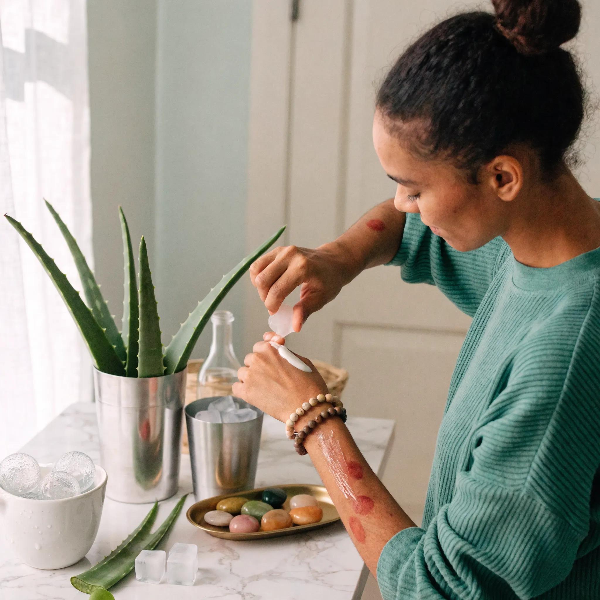 Person applying soothing lotion to skin post-cupping therapy in a tranquil setting emphasizing self-care and healing