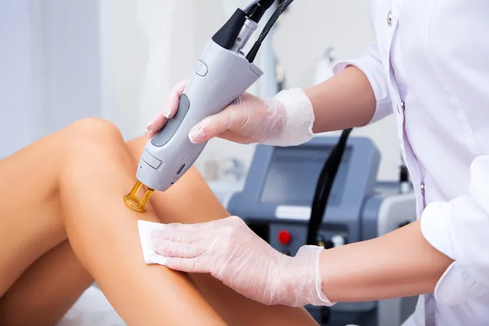 Laser hair removal Glenham