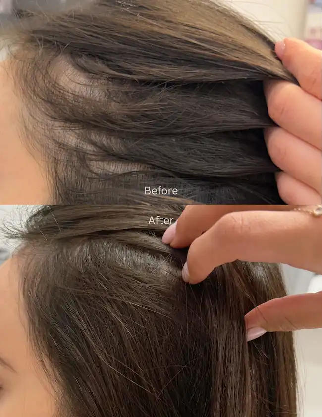 Non-Surgical Hair Restoration for Thinning Hair