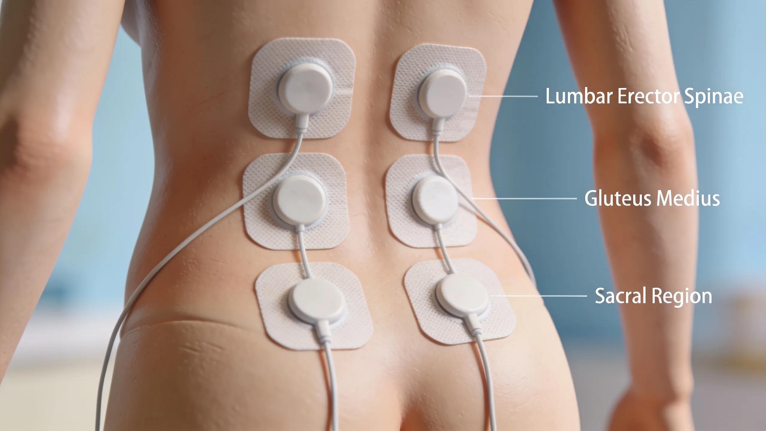 Proper electrode placement techniques for TENS therapy demonstrated on a model's lower back