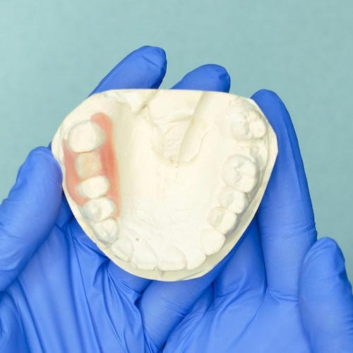 Comfortable Wisdom Tooth Surgery in Richmond BC