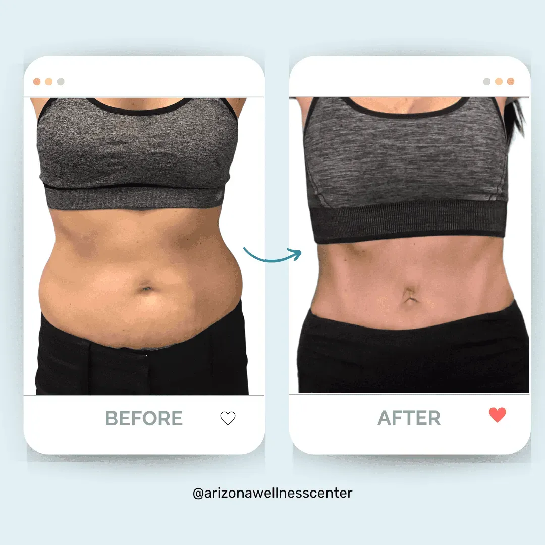 Mesa Semaglutide Weight Loss: Arizona Wellness Center