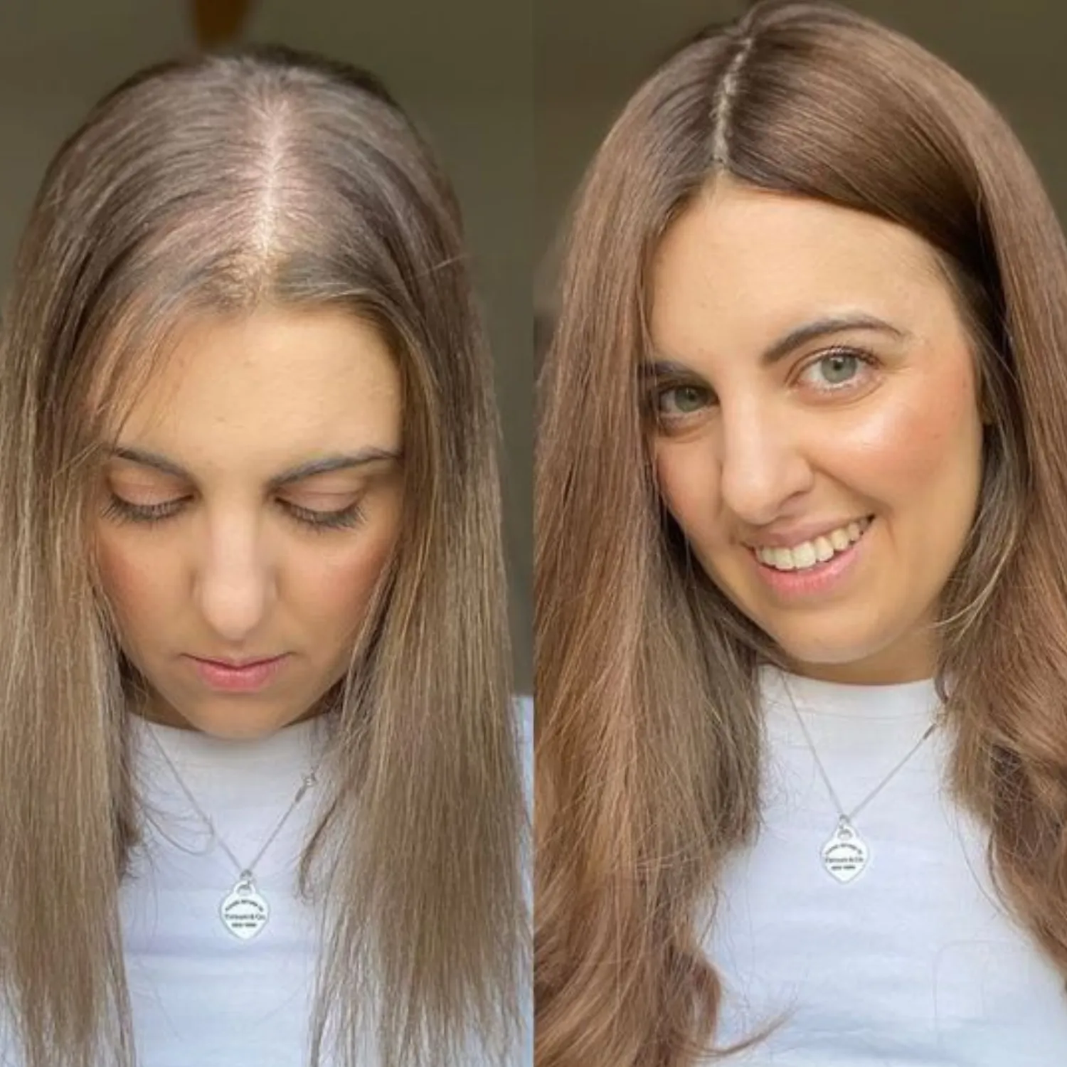Elegant Hair Toppers for Women at Refined Beauty Naperville