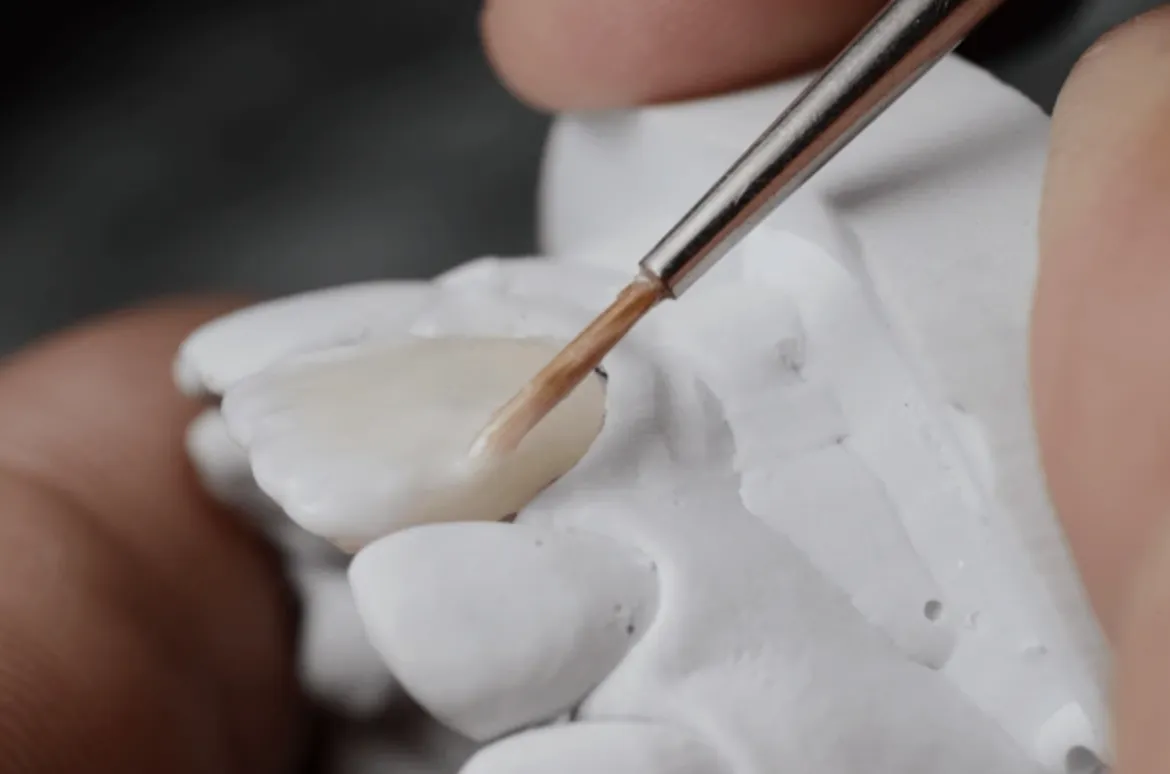 Revitalize Your Smile with Cosmetic Bonding in Provo