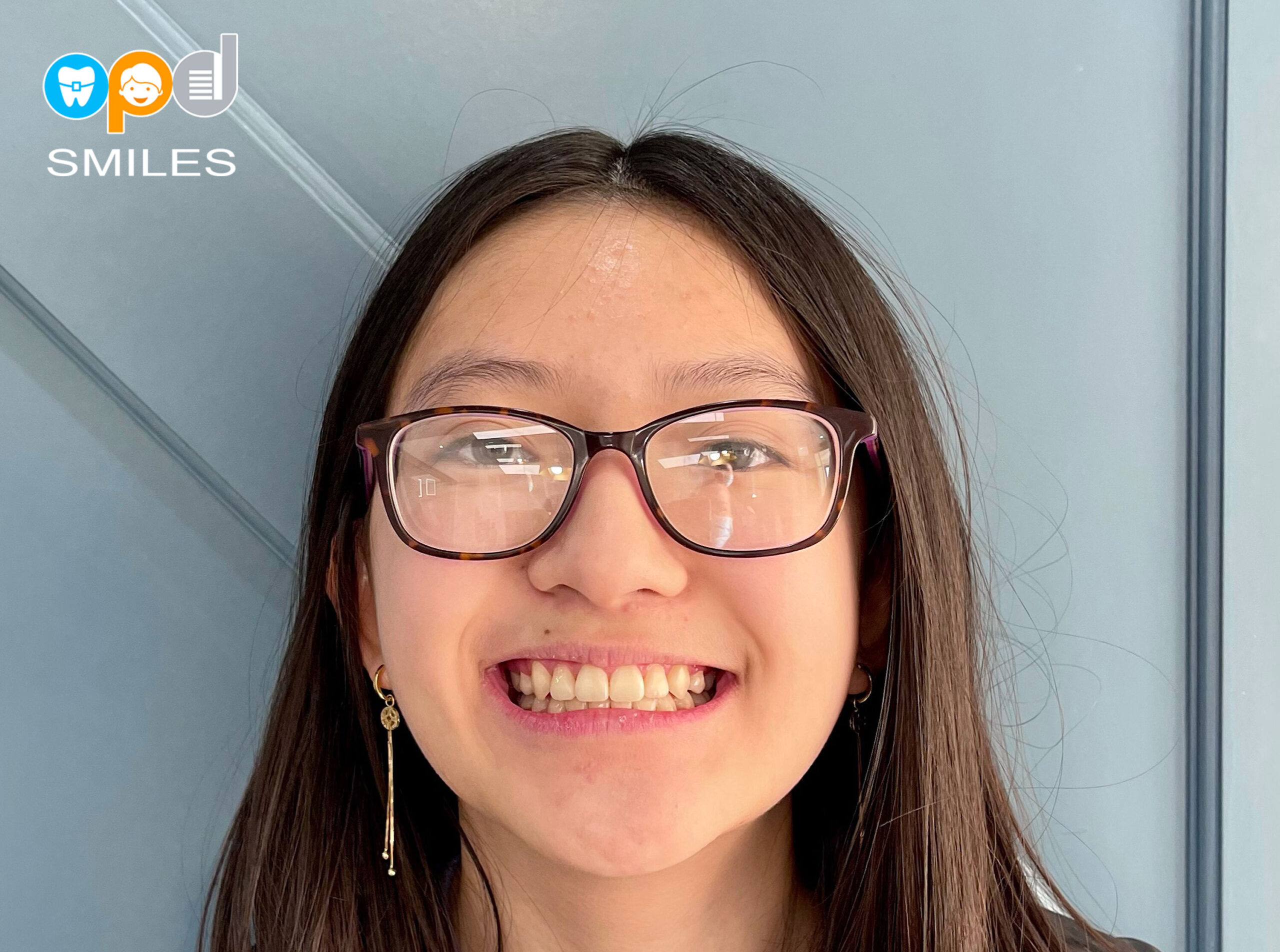 Pediatric Dental Emergencies in Allen TX | OPD Smiles