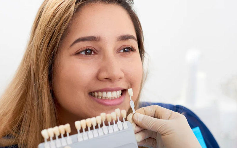 Advantages of Selecting Porcelain Veneers