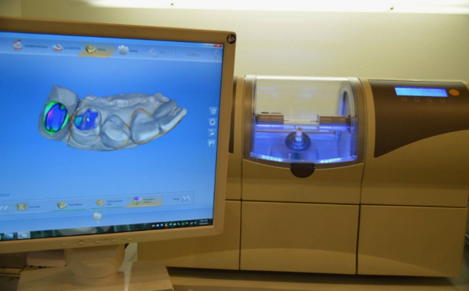 Swift and Reliable CEREC Crowns in Miami from A1 Care