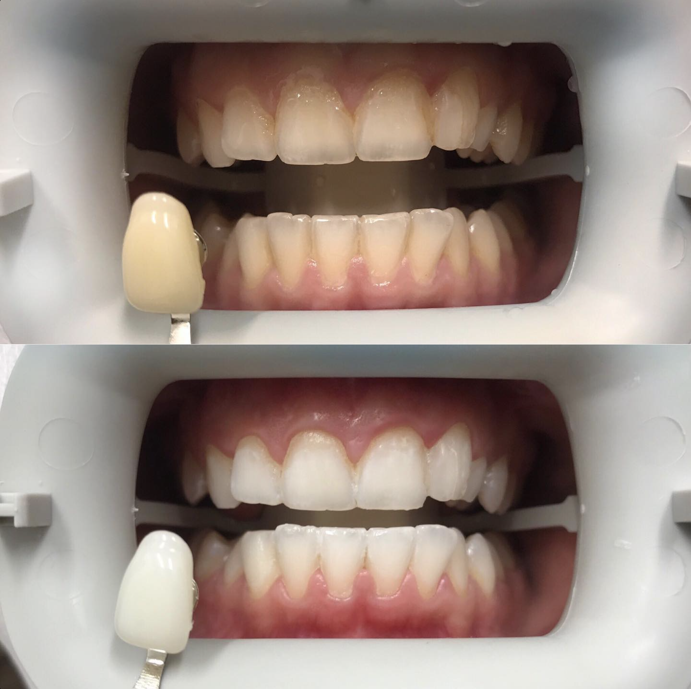 Creating a Stress-Free Dental Experience