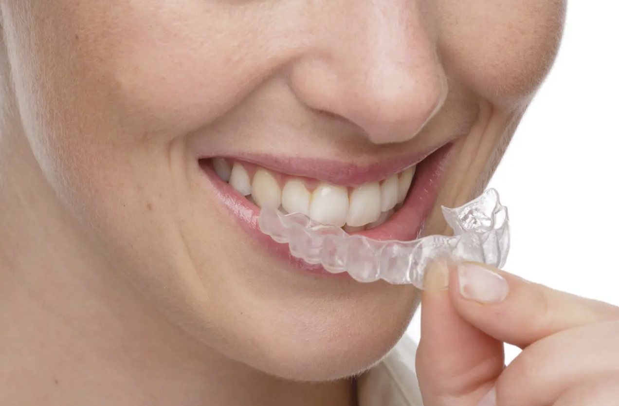 The Invisalign Process Explained