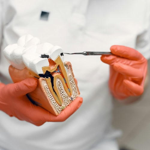 Clear Cost Information for Wisdom Tooth Removal in Richmond