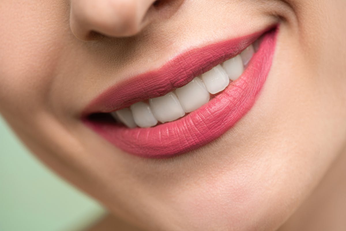 Treatment Options for Your Bridal Smile