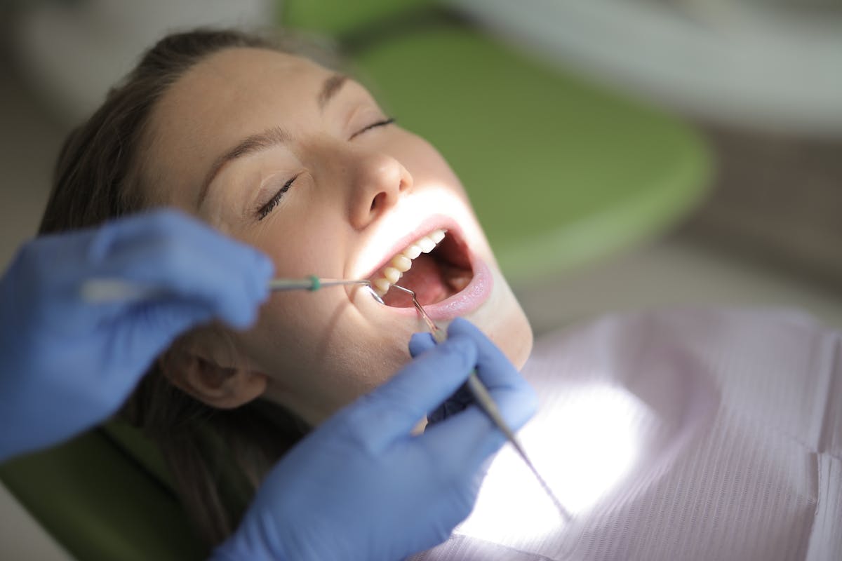 The Porcelain Veneer Process