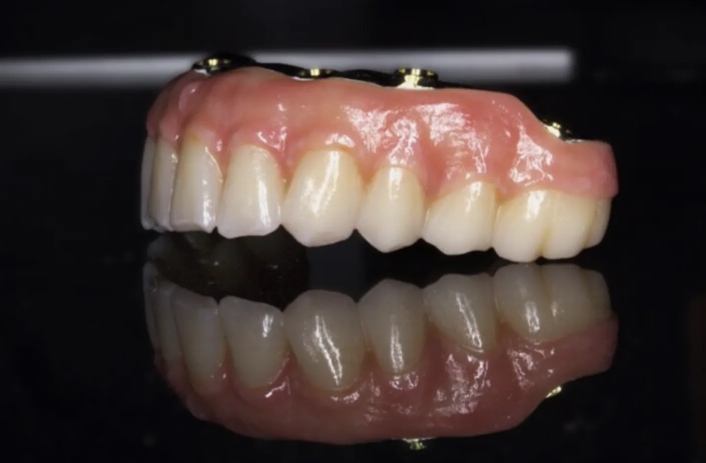 Revamp Your Smile with Our Comprehensive Full-Arch Restoration Guide