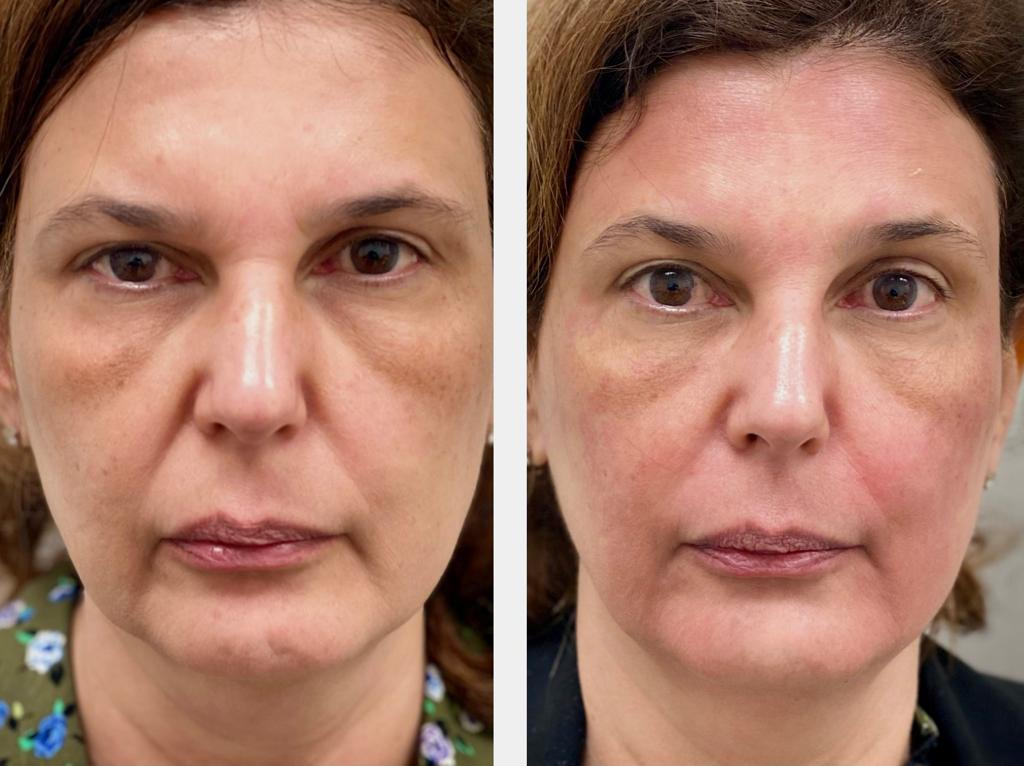Comprehensive Skin Rejuvenation Services