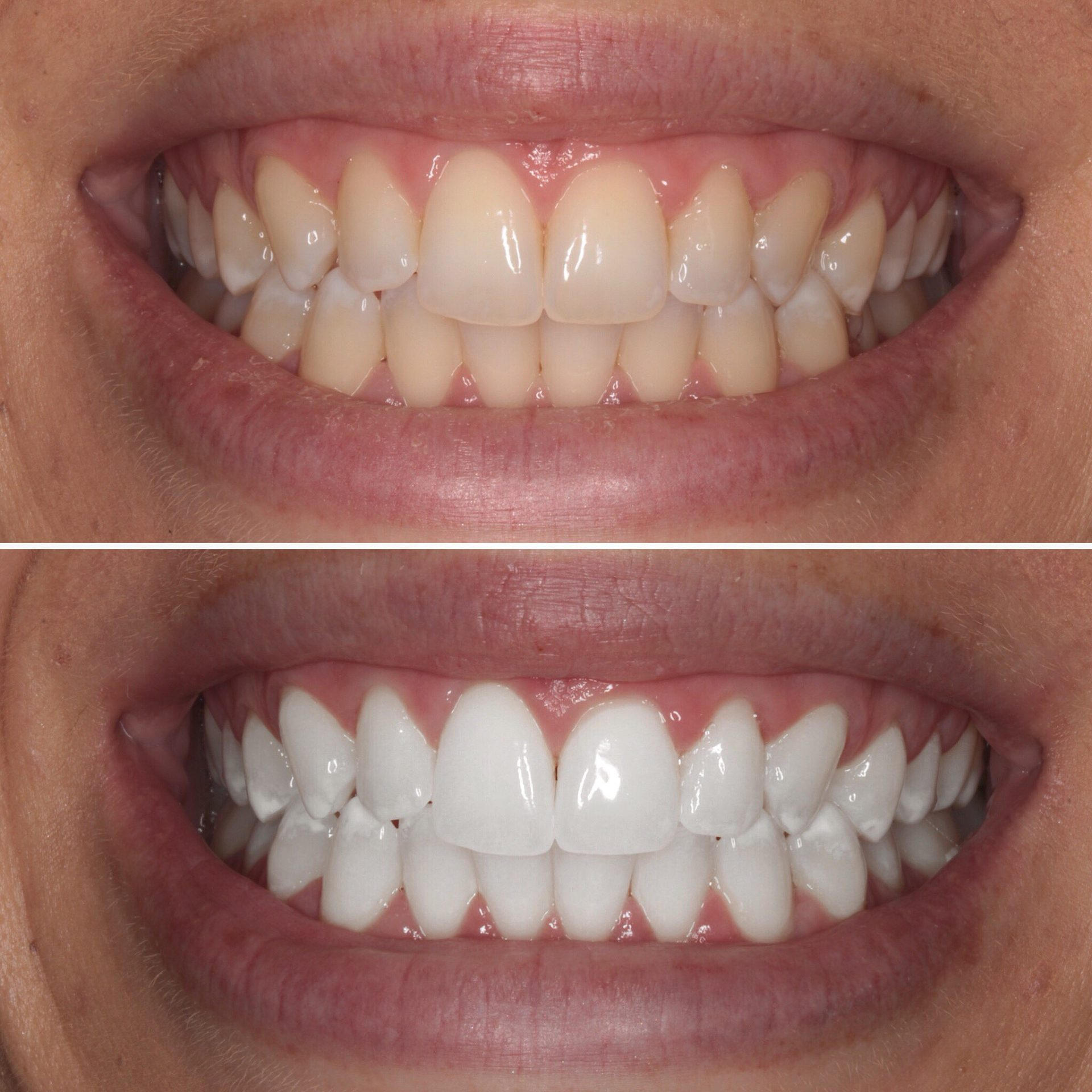 <a href="https://www.dentistryrichmond.ca/">Painless Root Canal Treatments</a>