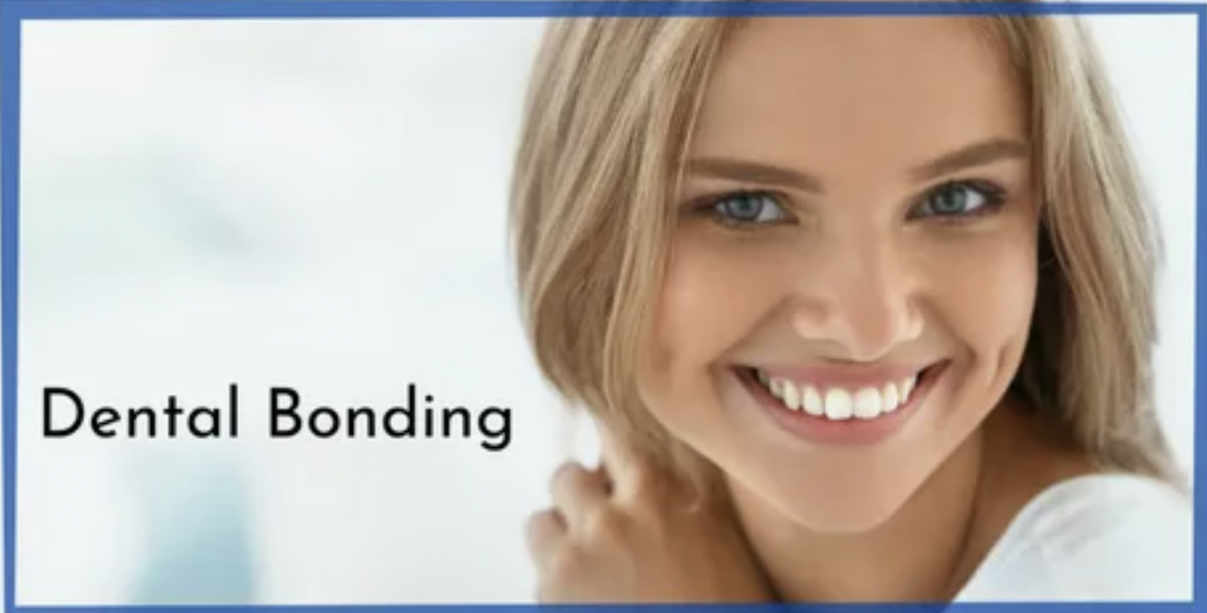 Benefits of Dental Bonding