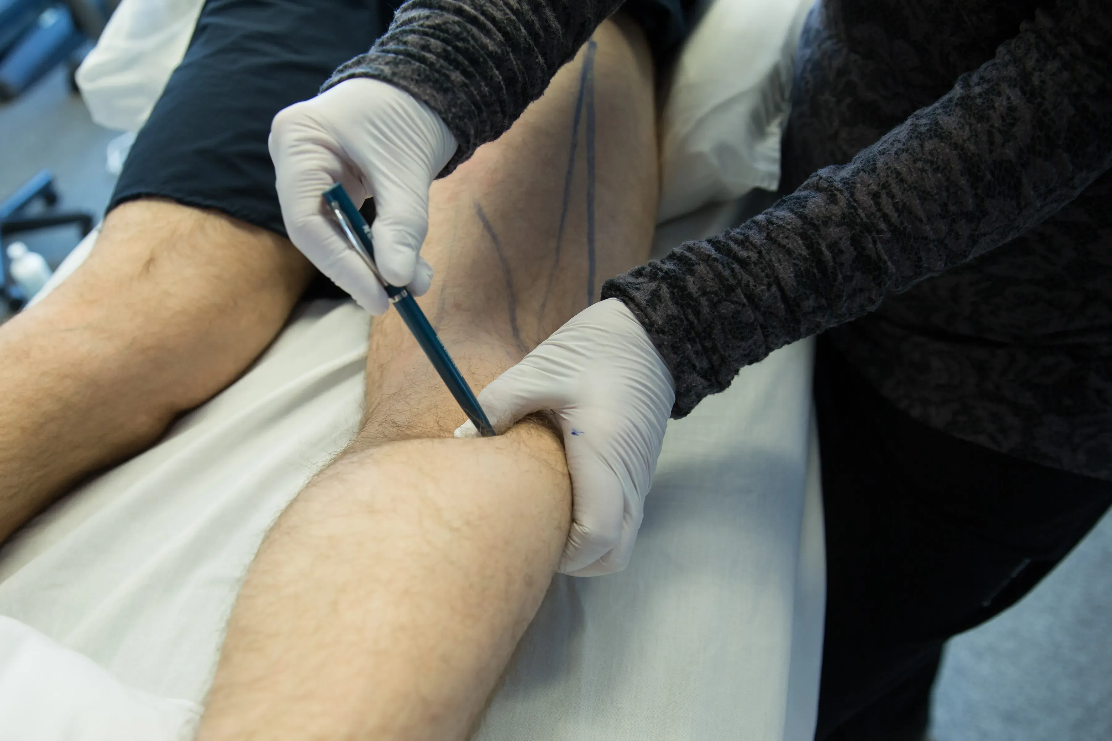 A Progressive Dry Needling Program Designed for Healthcare Professionals