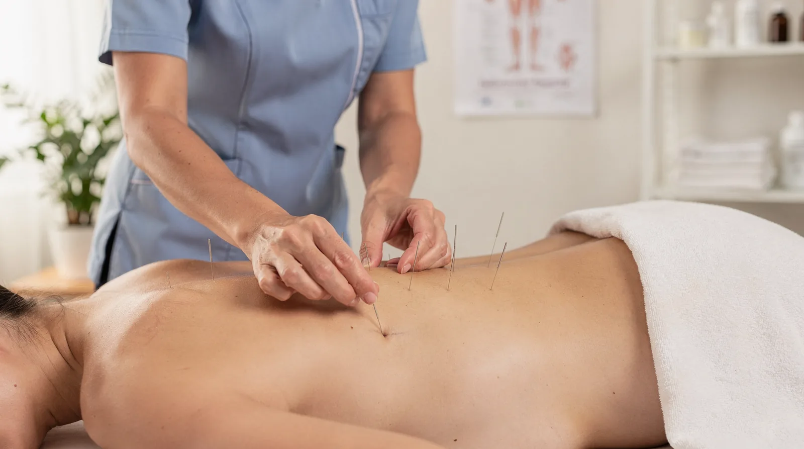 Acupuncture needles stimulate the body's central nervous system and immune system to react to illness