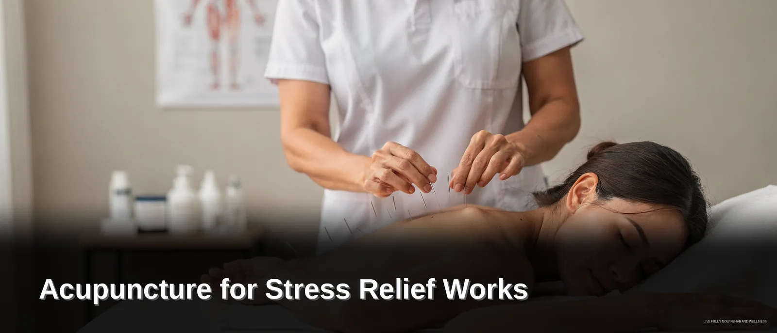 Acupuncture is a recognized treatment for individuals experiencing increased or chronic stress levels.; A randomized