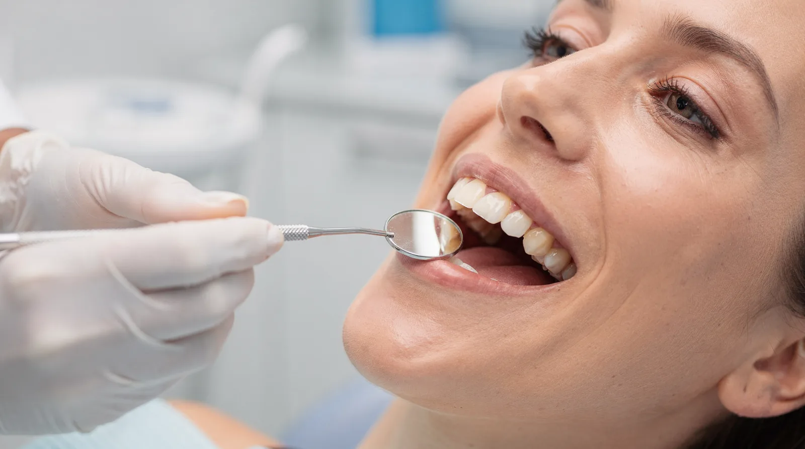 Molars are usually the hardest teeth to clean, which makes them a favorite hiding spot