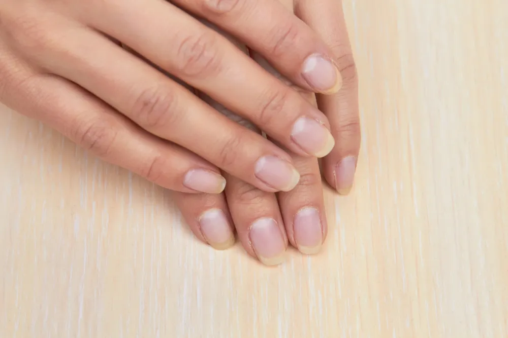 Natural Nail Care: female hands with not polished nails