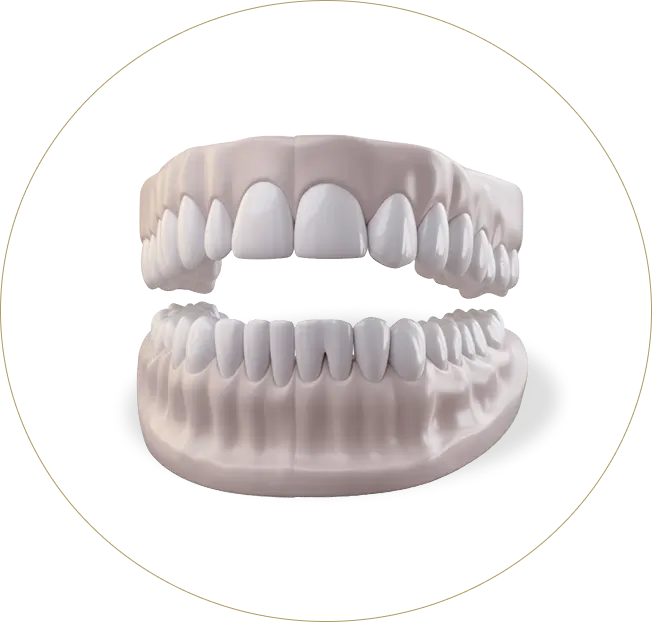A 3D anatomical illustration of healthy human teeth and gums, highlighting the seamless integration of white restorations at Issa Dental Group.