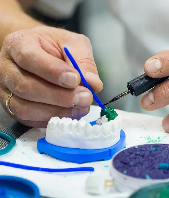 A dental professional demonstrating the intricate structure of a dental implant bridge on a mold to help patients understand home maintenance requirements.