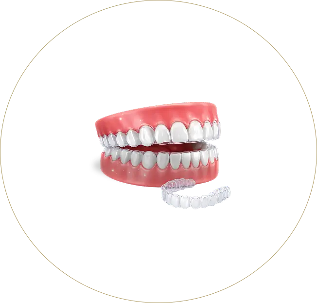 Clear Invisalign aligners and dental model for orthodontic treatment at Issa Dental Group.