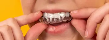 Invisalign at Issa Dental Group.