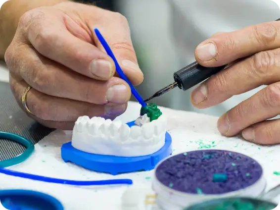 Close-up of a dental professional working on a teeth model for a socket preservation and bone grafting plan.