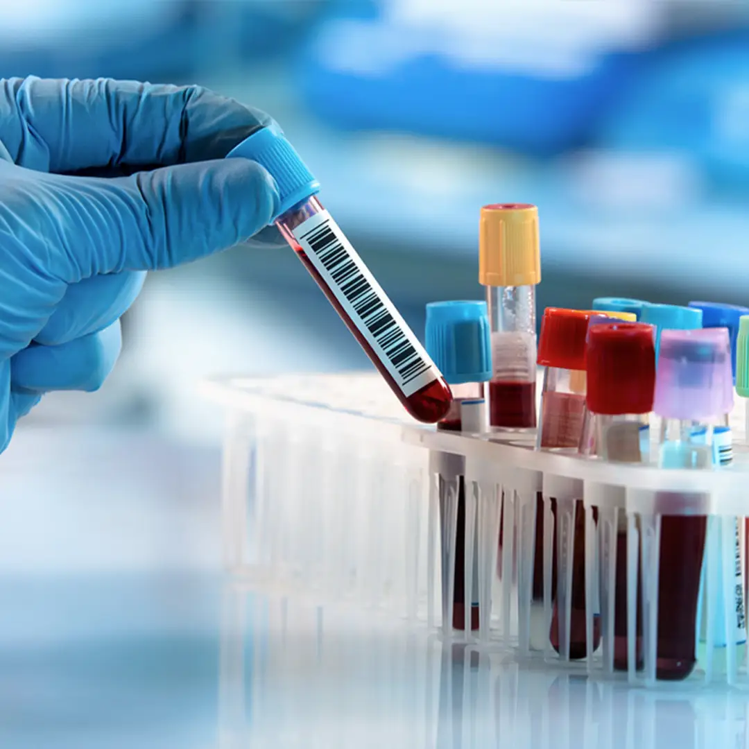 Copertina del corso: Interpretazione naturopatica degli esami di laboratorio e Alterazioni funzionali umane