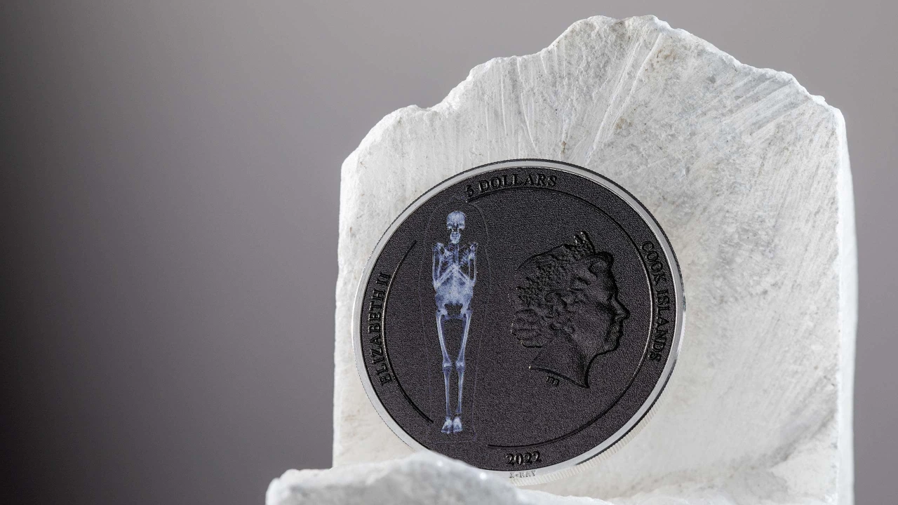X-Ray 2022 – Mummy