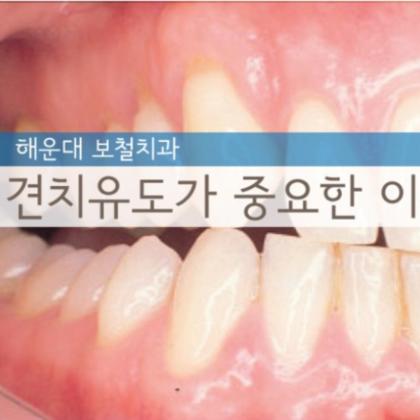 견치유도가-중요한-이유